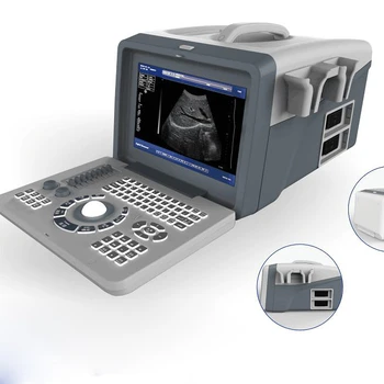 Maya Lekárske Ultrazvuk Skener MY-A001B plný digitálny diagnostický systém CRT prenosné zariadenia Ultrasonido